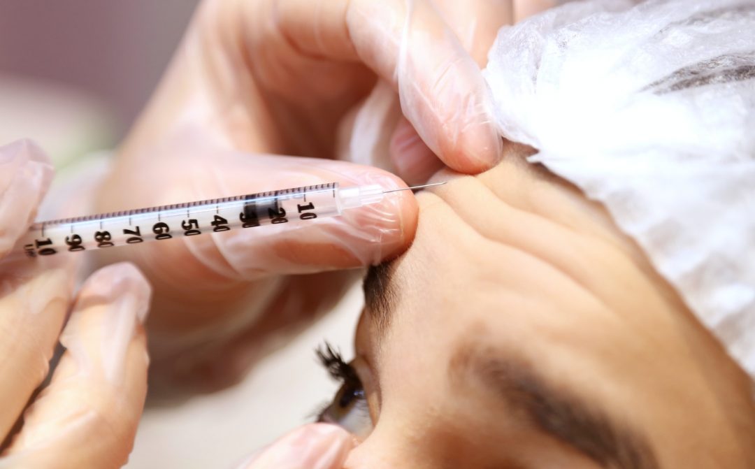 Νέα έρευνα αποκαλύπτει πώς το botox επηρεάζει τον εγκέφαλο